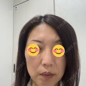 TCB東京中央美容外科 神戸院口コミ