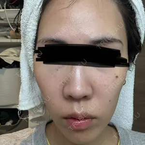 メディアージュクリニック 大阪梅田院口コミ