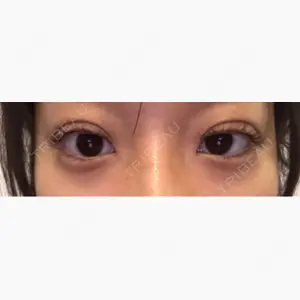 アリエル美容クリニック 大宮院口コミ