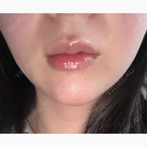 ルラ美容クリニック 新潟院口コミ