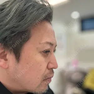 エースクリニック 大阪梅田HEPナビオ院口コミ