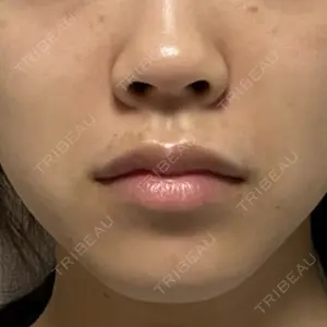 EMMO FACE CLINIC 東京三田院口コミ