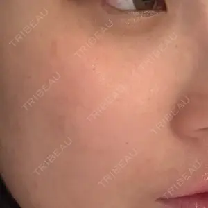 ライズワン美容皮膚科クリニック口コミ