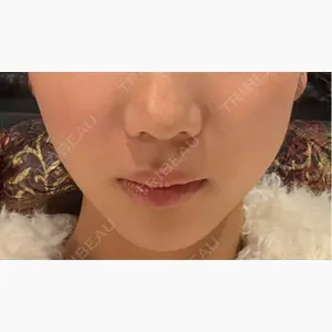 ルラ美容クリニック 静岡院口コミ