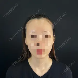 藤・ナチュレ美容クリニック 銀座院口コミ