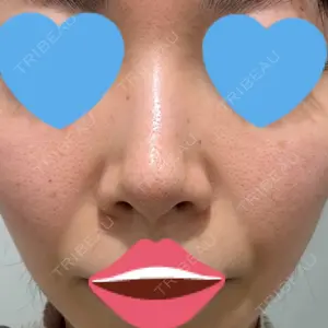 ウィルビークリニック 新宿院口コミ