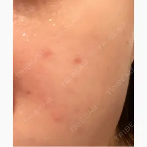 ジュエルクリニック 恵比寿院口コミ