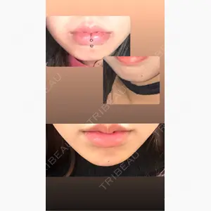 千葉美容外科アイビークリニック口コミ