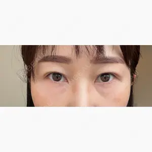 新宿Ladies&Gentlemen美容クリニック口コミ