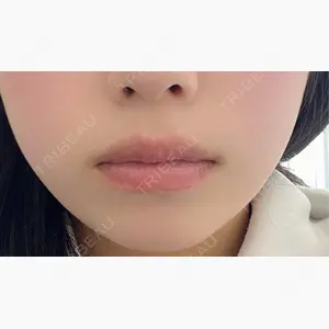 ルラ美容クリニック 宇都宮院口コミ