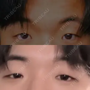 ルラ美容クリニック 札幌大通り院口コミ