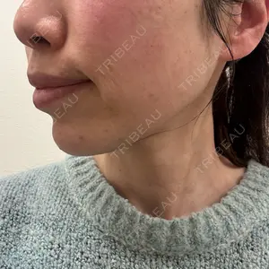 フィラークリニック 大阪心斎橋院口コミ