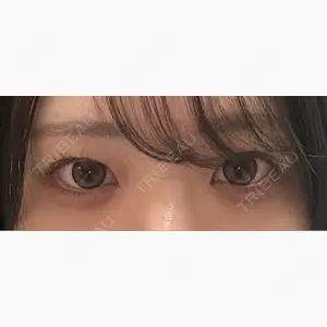 ルラ美容クリニック 名古屋栄院 / ルラスキンクリニック 名古屋栄院口コミ