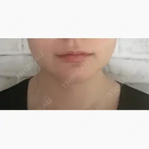 東京美容外科 福岡院口コミ