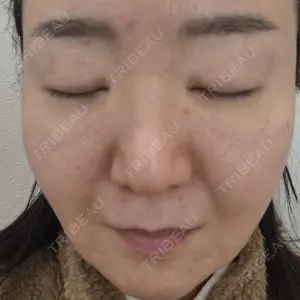 Zetith Beauty Clinic 銀座院口コミ