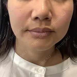 AURORA CLINIC（オーロラクリニック）新宿院口コミ