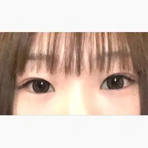 アリエル美容クリニック 大宮院口コミ