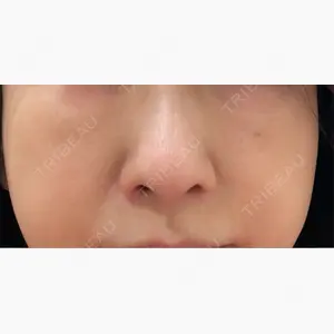 小倉美容外科/美容皮膚科 ビラビューティークリニック口コミ