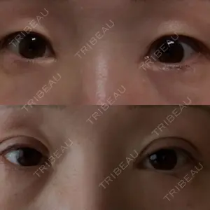 eクリニック 福岡院口コミ