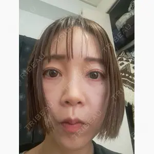 BiBiクリニック口コミ