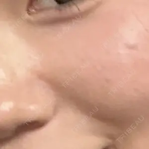 新宿Ladies&Gentlemen美容クリニック口コミ