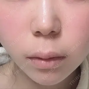 HAAB×DREAM BEAUTY CLINIC 東京本院口コミ