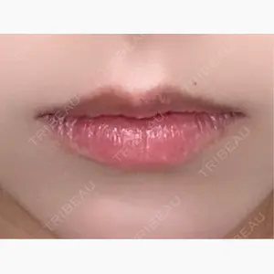 ルラ美容クリニック 千葉院 / ルラスキンクリニック 千葉院口コミ