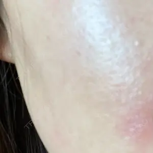 ルラ美容クリニック 岡山院口コミ