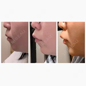 HINATA クリニック口コミ