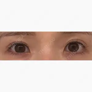 AI Beauty Clinic （エーアイ美容クリニック）口コミ