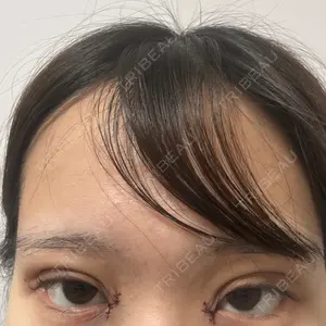 愛知春日井美容外科ネビュラクリニック口コミ