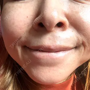 ルラ美容クリニック 郡山院口コミ