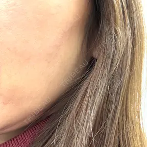 ルラ美容クリニック 札幌本院口コミ