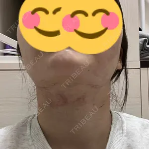 おおかみ美容のクリニック 新宿院口コミ