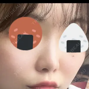 A CLINIC（エークリニック） 大阪院口コミ