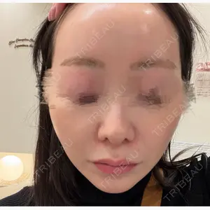 Chloe Cheongdam Clinic （クロエチョンダムクリニック）口コミ