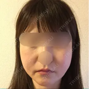 ラボム整形外科口コミ