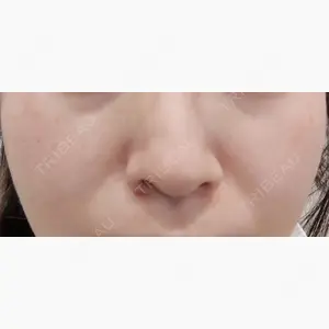 ルラ美容クリニック 宇都宮院口コミ