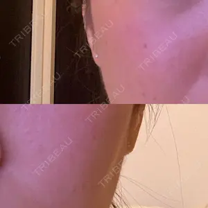 DAILY SKIN CLINIC 新宿院口コミ