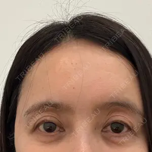 PRO CLINIC プロクリニック 銀座院口コミ