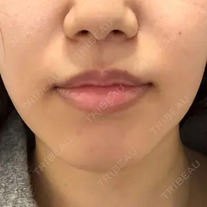 フィラークリニック 大阪心斎橋院口コミ