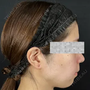 藤・ナチュレ美容クリニック 銀座院口コミ