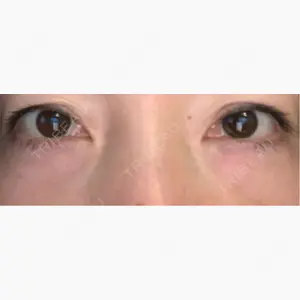 AI Beauty Clinic （エーアイ美容クリニック）口コミ