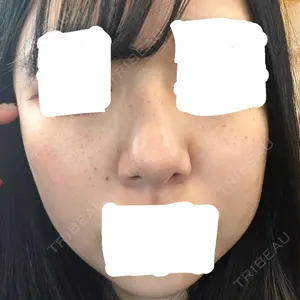 梅田すずらんクリニック口コミ