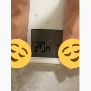 脂肪吸引ラボトウキョウ口コミ