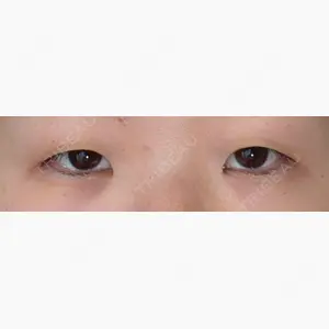 オアシス美容外科口コミ
