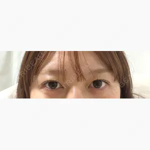 パルム美容クリニック口コミ