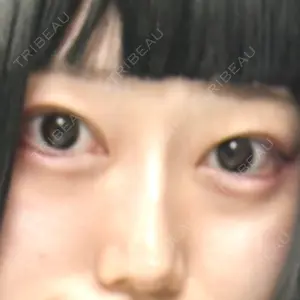 LEX BEAUTY CLINIC口コミ