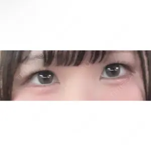 愛知春日井美容外科ネビュラクリニック口コミ