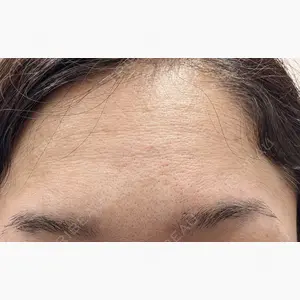 ゆきスキンクリニック 東池袋口コミ